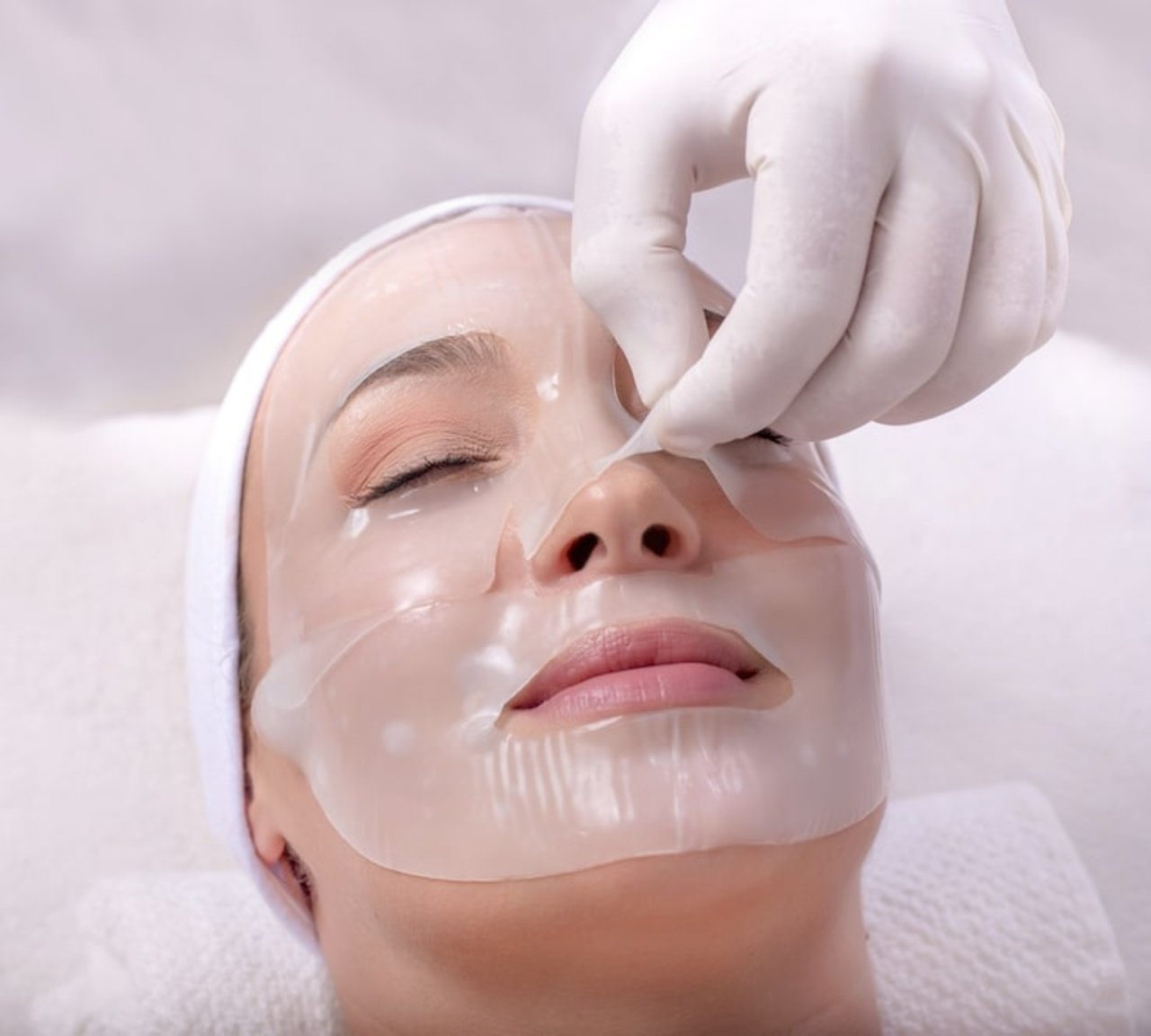 chemical peel