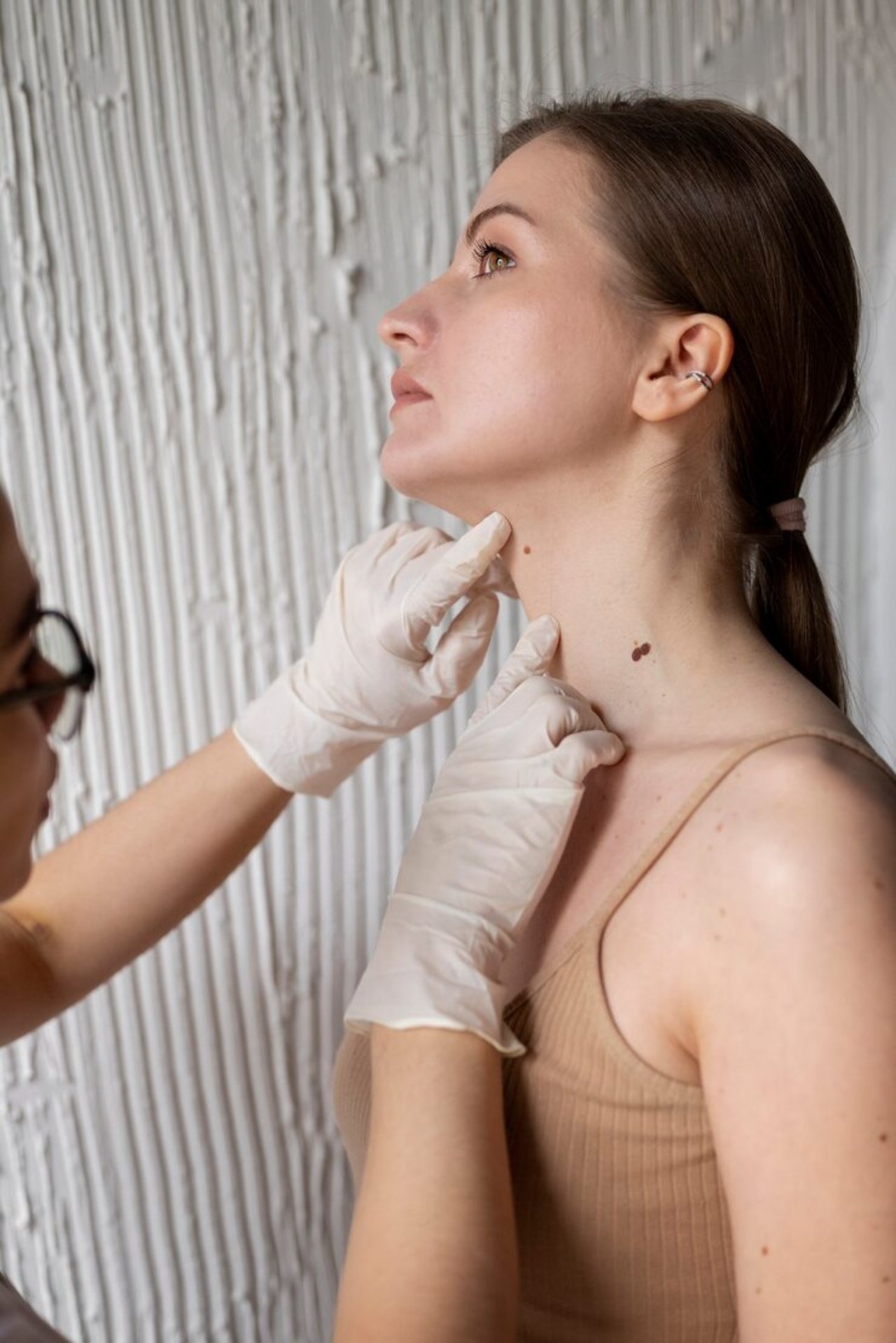 skin tag removal